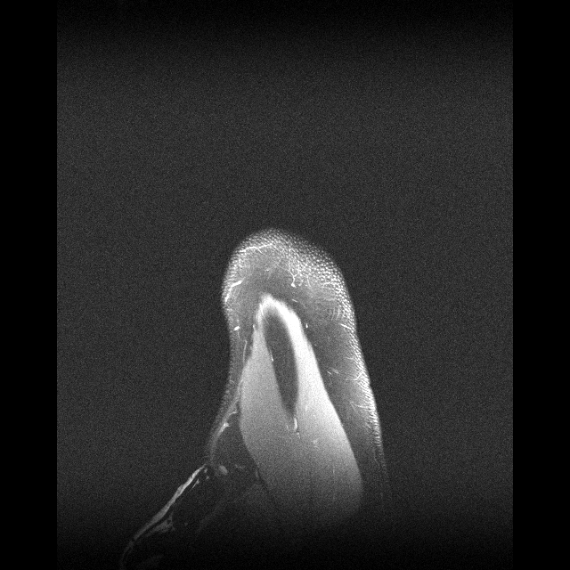 Shoulder axial RSS sample